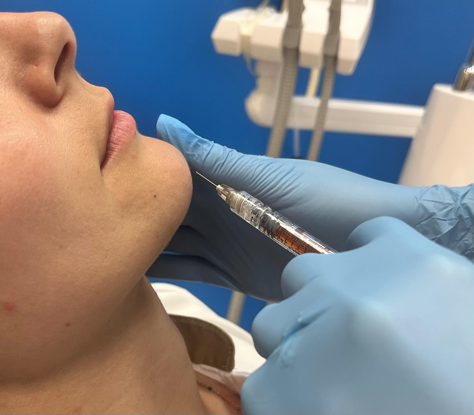armoniacion-facial